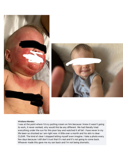 Mella Skin Eczema Cream