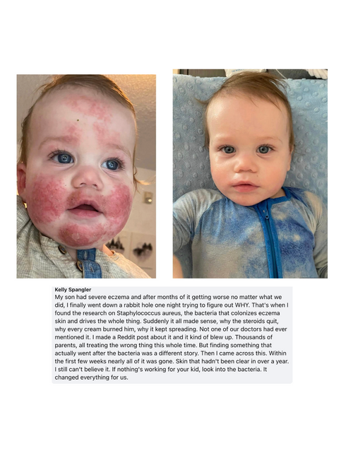 Mella Skin Eczema Cream