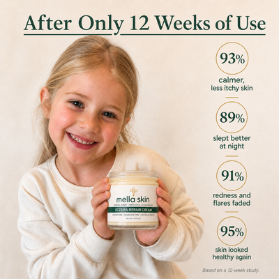 Mella Skin Eczema Cream