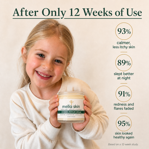 Mella Skin Eczema Cream