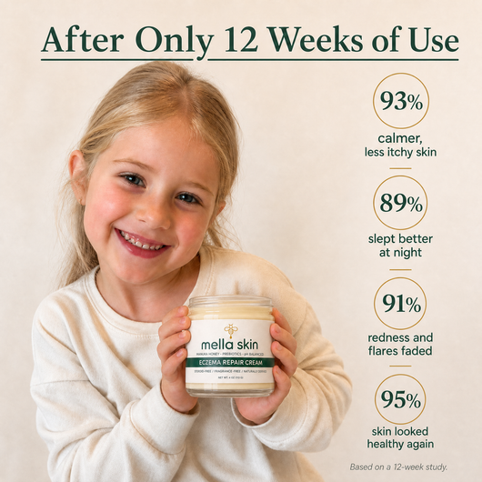 Mella Skin Eczema Cream